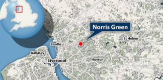 FOREIGN: Boy, four, is seriously injured after being mauled by bull mastiff-type