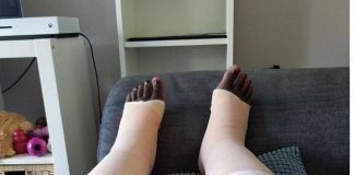 MIRACLE: How God rearranged my broken bones after being involved in an accident” — Lady recounts