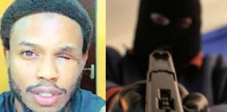 Man Loses Eye While Fighting Armed Robbers In Abuja, says He Doesn’t Regret Defending His Family