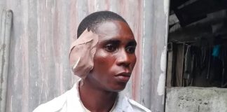 Driver Reportedly Bites Off VIO Officer’s Ear To The Ground (Photo)