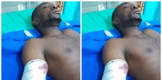 Industrial Machine Cuts Off Worker’s Hand In Ogun, Police Begin Probe