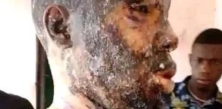 Details Emerge As Woman Bathes Husband With Hot Oil